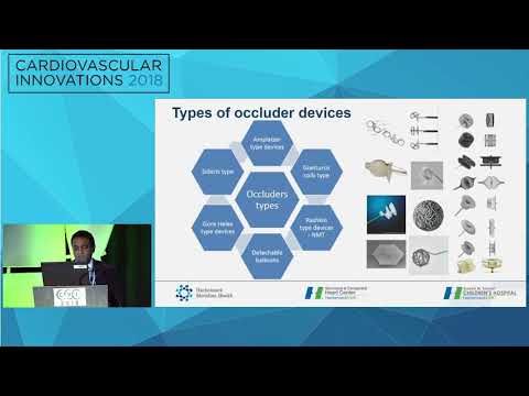 CVI2018 Session: Design needs for device occluders - Tilak Pasala, MD