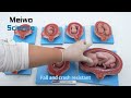 Video 1