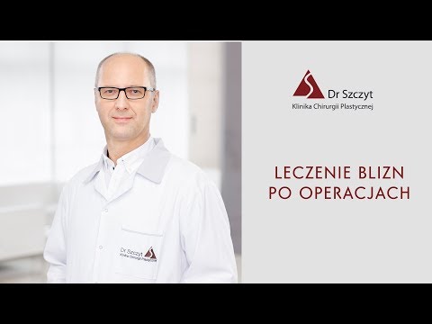 Jak zadowolić mężczyznę z małym penisem Stwarza z małego penisa u mężczyzn