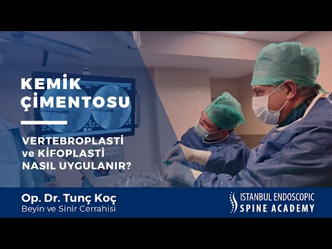 Kemik Çimentosu Vertebroplasti ve Kifoplasti Nedir, Nasıl Uygulanır