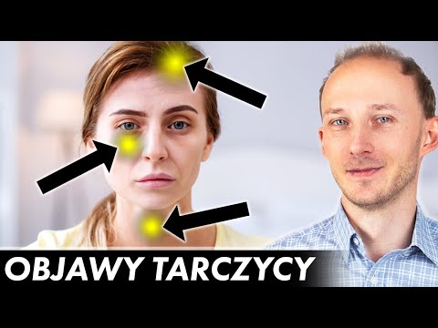 17 oznak, że Twoja tarczyca woła o pomoc! Niedoczynność tarczycy: objawy | Dr Bartek Kulczyński
