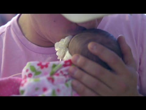 Conjoined Twins at The Children's Hospital at OU Medical Center