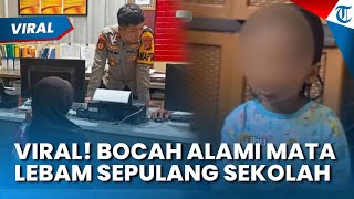Viral! Bocah di Palembang Alami Mata Lebam Sepulang Sekolah, Ibu Lapor ke Polisi, Dugaan Kekerasan?