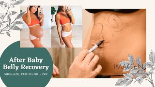 After Baby Belly Recovery - Treating Loose Skin After Pregnancy