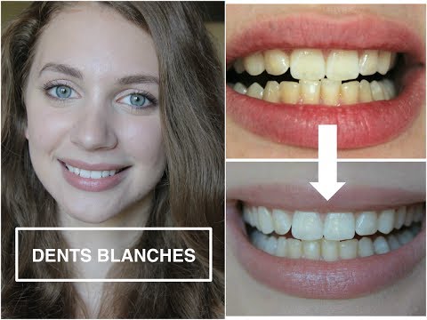 comment retrouver des dents blanches