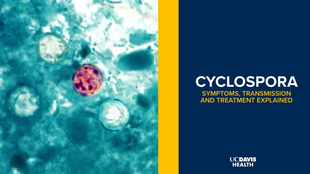 Thumbnail preview of Cyclospora Parasite Outbreak: Symptoms, Treatment and How It Spreads