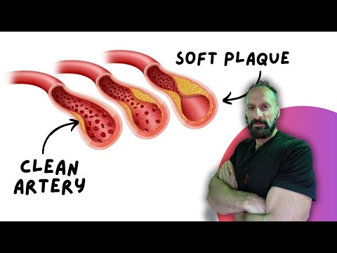 5 Overlooked Nutrients That Reverse Artery Damage Naturally