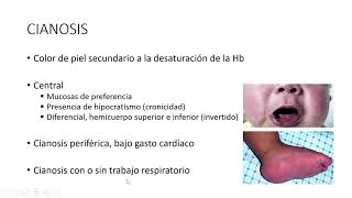 SEMILOLOGIA CV parte II