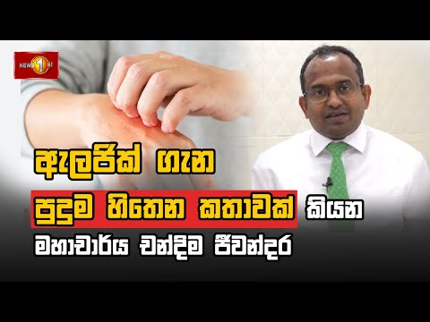 ඇලජික් ගැන පුදුම හිතෙන කතාවක් කියන මහාචාර්ය චන්දිම ජීවන්දර #Allergy