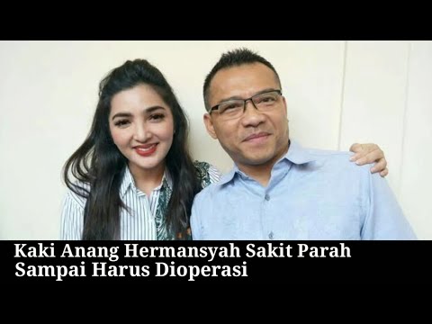 Kaki Anang Hermansyah Sakit Parah Sampai Harus Dioperasi