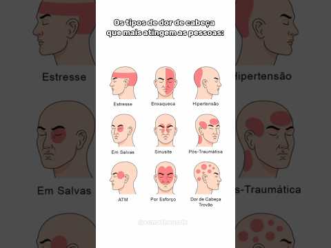 Os tipos de dor de cabeça que mais atingem as pessoas #shorts