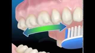 Cepillado dental - Galindo Dentistas | Clinica Dental en Málaga