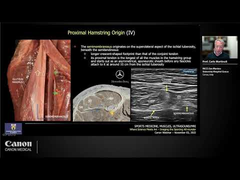 Ultrasound of Hamstring Injuries: What Should We Know and Look At
