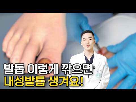 내성발톱 악화시키는 절대 하면 안 되는 행동!