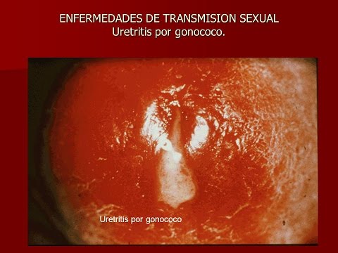 Frutti di mare per la potenza maschile Potenza nelle donne di 40 anni