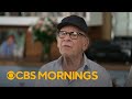 Music icon Art Garfunkel speaks about his decades-long experience with psoriasis