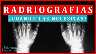 Antes de sacarte Radiografías!! Ve este video 🙄