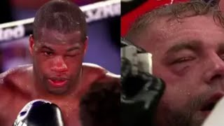 BillyJoe Saunders gives his thoughts on other fighters Quitting￼ with identical eye injury🤔