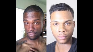 Man Lightens His Skin Using ‘Natural Remedies’ | HOOKED ON THE LOOK
