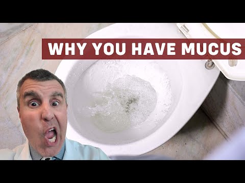 What Causes Mucus In Your Stool