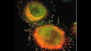 Cancer Facts : How Does a Person Die From Cancer?