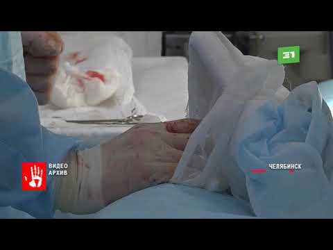 На координатора челябинского штаба Навального напали и избили