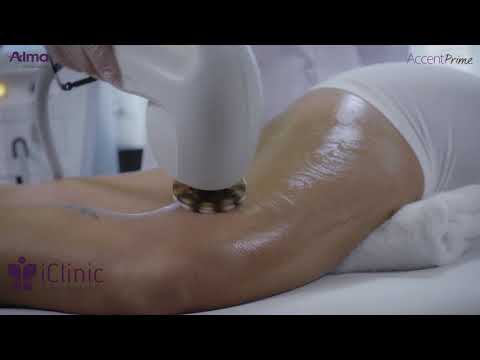 Стягане на кожата и терапия на целулит от iClinic