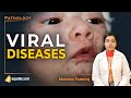 Viral Diseases | Smallpox | Pathology Video | Medical Education Channel | V-Learning