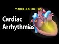 Cardiac Arrhythmias Animation