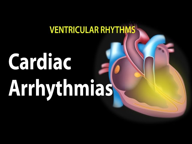 Video Pronunciation of arrhythmias in English