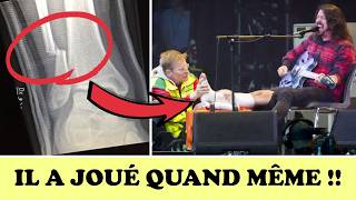 IL S'EST CASSÉ LA JAMBE SUR SCÈNE ! (le contoir musical #34)