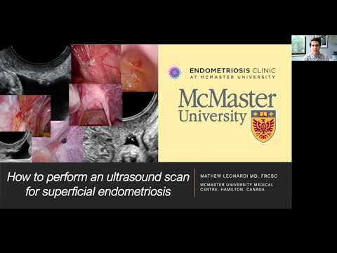 How to perform an ultrasound scan for superficial endometriosis by Mathew Leonardi