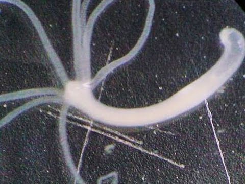 Antihelmintikus a pinwormok ellen