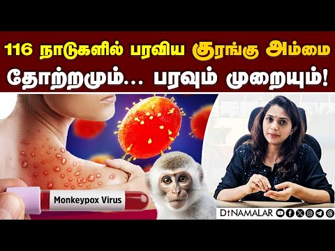 Seasonal Diseases | பருவமாற்றத்தால் ஏற்படும் நோய்கள்!! - தற்காத்துக்கொள்ள மருத்துவர்கள் TIPS!!
