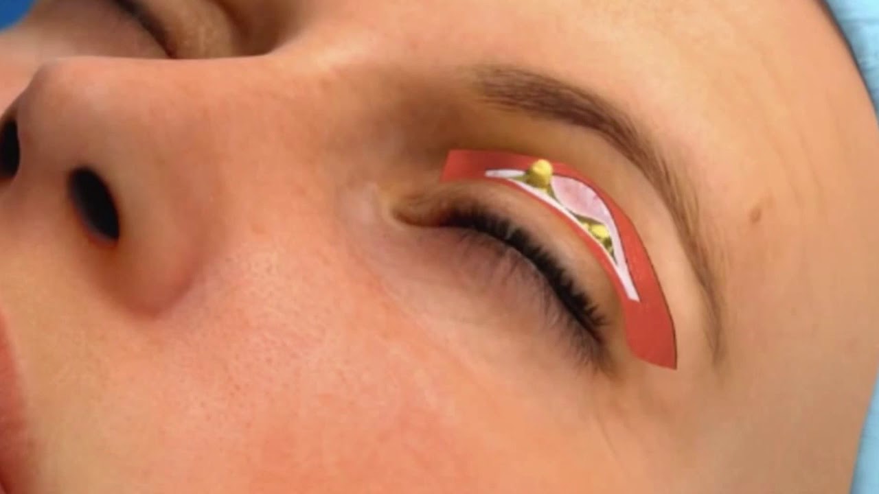 Jesús Abraham Acosta Leyva-7