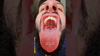 Download lagu WHAT HAPPENS IF YOU LOSE YOUR TONGUE❓ mp3