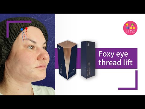 Foxy eye thread lift