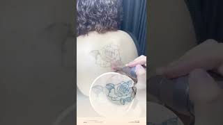 Laser Tattoo Removal