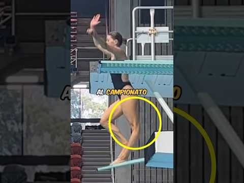 Un INFORTUNIO che mette i BRIVIDI! Immagini forti.. ⚠️🦵🏻 (@BrittanyObrienn) #shorts