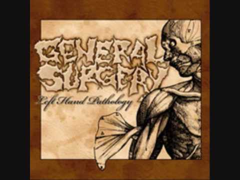 General Surgery - Convivial Corpse Disposal Methodology online metal music video by GENERAL SURGERY