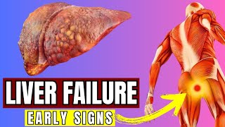 Recognizing Liver Disease: Signs, Symptoms, and Home Remedies"