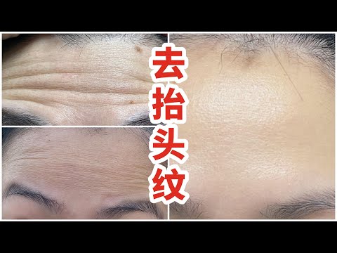 額頭皺紋