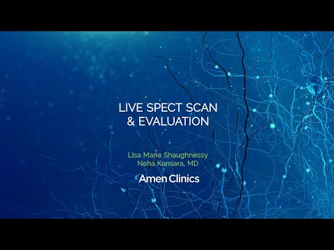 Live SPECT Scan & Evaluation - Amen Clinics