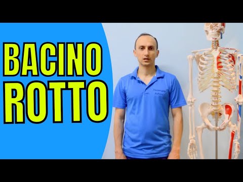 Pelvic Fracture: What Causes It and How to Recover