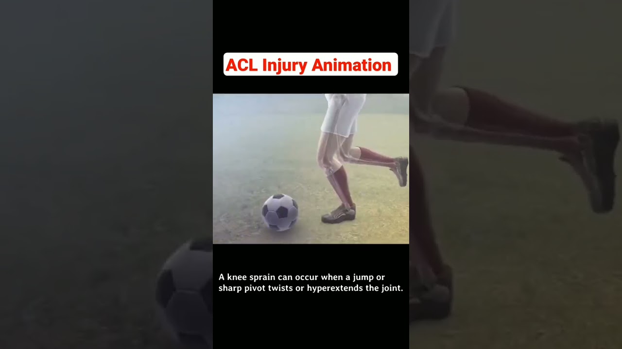 Marcos Michell Garcia Herrera-1