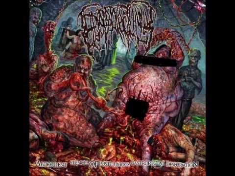 Epicardiectomy - Fornicating In Pulverized Feces