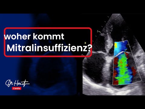 Massiert meine Prostata Mitglied Prostata Schmerzen im Anus