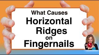 What Causes Horizontal Ridges on Nails With Karen Langston