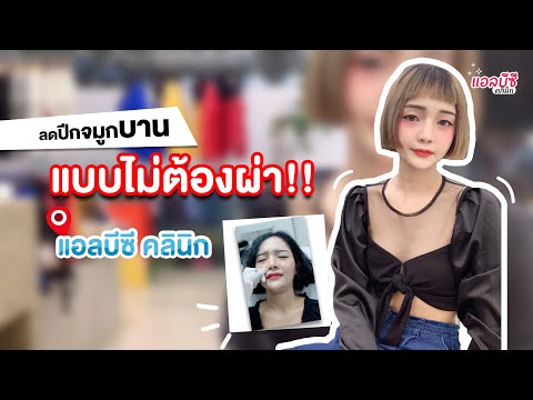 โบท็อก ปีกจมูก