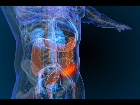 Oxazer oxaliplatin injection ip, aprazer